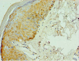 Immunohistochemistry of paraffin-embedded human skin tissue using RSAD2 Antibody at dilution of 1:100Rabbit anti-Human RSAD2 Polyclonal Antibody