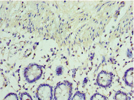 Immunohistochemistry of paraffin-embedded human colon tissue using RSAD2 Antibody at dilution of 1:100Rabbit anti-Human RSAD2 Polyclonal Antibody