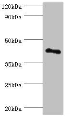 Western blot | All lanes: RSAD2 antibody at 8μg/ml + Jurkat whole cell lysate | Secondary | Goat polyclonal to rabbit IgG at 1/10000 dilution | Predicted band size: 42 kDa | Observed band size: 42 kDaRabbit anti-Human RSAD2 Polyclonal Antibody