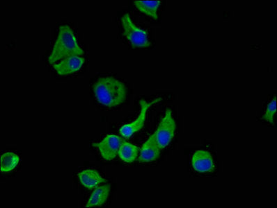 Immunofluorescence staining of MCF-7 cells with SORCS1 Antibody at 1:100, counter-stained with DAPI. The cells were fixed in 4% formaldehyde, permeabilized using 0.2% Triton X-100 and blocked in 10% normal Goat Serum. The cells were then incubated with the antibody overnight at 4°C. The secondary antibody was Alexa Fluor 488-congugated AffiniPure Goat Anti-Rabbit IgG(H+L).Rabbit anti-Human SORCS1 Polyclonal Antibody