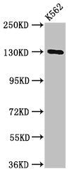 Western Blot | Positive WB detected in: K562 whole cell lysate | All lanes: SORCS1 antibody at 3μg/ml | Secondary | Goat polyclonal to rabbit IgG at 1/50000 dilution | Predicted band size: 130, 134, 132 kDa | Observed band size: 130 kDaRabbit anti-Human SORCS1 Polyclonal Antibody