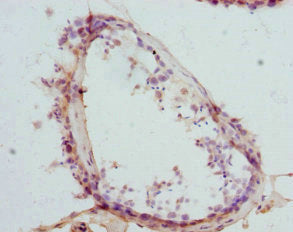 Immunohistochemistry of paraffin-embedded human testis tissue using CTNNBL1 Antibody at dilution of 1:100Rabbit anti-Human CTNNBL1 Polyclonal Antibody