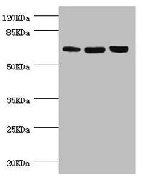 Western blot  | All lanes: CTNNBL1 antibody at 5.39µg/ml  | Lane 1: Hela whole cell lysate  | Lane 2: Jurkat whole cell lysate  | Lane 3: 293T whole cell lysate  | Secondary  | Goat polyclonal to rabbit IgG at 1/10000 dilution  | Predicted band size: 66, 44, 37, 62 kDa  | Observed band size: 66 kDaRabbit anti-Human CTNNBL1 Polyclonal Antibody