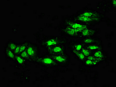 Immunofluorescent analysis of Hela cells using ERCC4 Antibody at dilution of 1:100 and Alexa Fluor 488-congugated AffiniPure Goat Anti-Rabbit IgG(H+L)Rabbit anti-Human ERCC4 Polyclonal Antibody