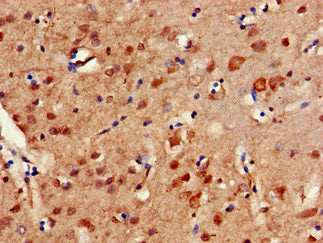 Immunohistochemistry of paraffin-embedded human brain tissue using the antibody at dilution of 1:100Rabbit anti-Human ERCC4 Polyclonal Antibody