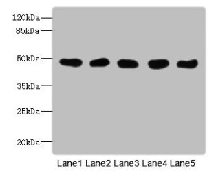 Western Blot  | All lanes: GCDH antibody at 8μg/ml  | Lane 1: Mouse kidney tissue  | Lane 2: Mouse liver tissue  | Lane 3: Hela whole cell lysate  | Lane 4: MCF-7 whole cell lysate  | Lane 5: LO2 whole cell lysate  | Secondary  | Goat polyclonal to rabbit IgG at 1/10000 dilution  | Predicted band size: 49, 48 kDa  | Observed band size: 49 kDaRabbit anti-Human GCDH Polyclonal Antibody
