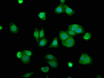 Immunofluorescence staining of HepG2 cells with ARL11 Antibody at 1:100, counter-stained with DAPI. The cells were fixed in 4% formaldehyde, permeabilized tissue using 0.2% Triton X-100 and blocked in 10% normal Goat Serum. The cells were then incubated with the antibody overnight at 4°C.The secondary antibody was Alexa Fluor 488-congugated AffiniPure Goat Anti-Rabbit IgG (H+L).Rabbit anti-Human ARL11 Polyclonal Antibody