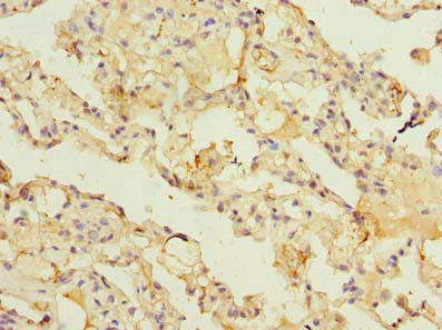 Immunohistochemistry of paraffin-embedded human lung tissue using the antibody at dilution of 1:100