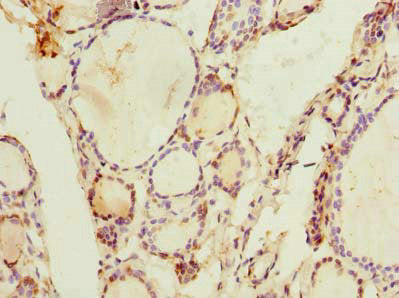 Immunohistochemistry of paraffin-embedded human thyroid tissue using ARL11 Antibody at dilution of 1:100Rabbit anti-Human ARL11 Polyclonal Antibody