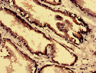 Immunohistochemistry analysis of human prostate tissue using CPNE4 Antibody at dilution of 1:100Rabbit anti-Human CPNE4 Polyclonal Antibody
