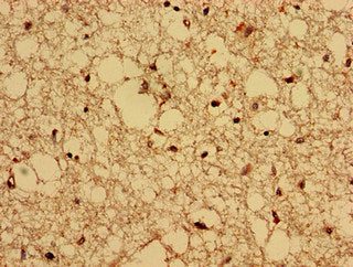 Immunohistochemistry analysis of human brain tissue using CPNE4 Antibody at dilution of 1:100Rabbit anti-Human CPNE4 Polyclonal Antibody