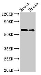 Western Blot | Positive WB detected in: Rat brain tissue, Mouse brain tissue | All lanes: CPNE4 antibody at 2μg/ml | Secondary | Goat polyclonal to rabbit IgG at 1/50000 dilution | Predicted band size: 63, 65 kDa | Observed band size: 63 kDaRabbit anti-Human CPNE4 Polyclonal Antibody
