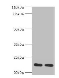 Western blot | All lanes: RERG antibody at 2μg/ml | Lane 1: Mouse thymus tissue | Lane 2: Rat lung tissue | Secondary | Goat polyclonal to rabbit at 1/10000 dilution | Predicted band size: 23, 21 kDa | Observed band size: 23 kDa