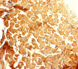 Immunohistochemistry of paraffin-embedded human heart tissue using GALM Antibody at dilution of 1:100Rabbit anti-Human GALM Polyclonal Antibody