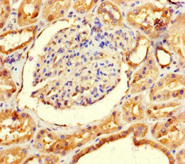 Immunohistochemistry of paraffin-embedded human kidney tissue using GALM Antibody at dilution of 1:100Rabbit anti-Human GALM Polyclonal Antibody