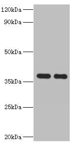 Western blot  | All lanes: GALM antibody at 2µg/ml  | Lane 1: Mouse kidney tissue  | Lane 2: Rat adrenal gland tissue  | Secondary  | Goat polyclonal to rabbit IgG at 1/10000 dilution  | Predicted band size: 38 kDa  | Observed band size: 38 kDaRabbit anti-Human GALM Polyclonal Antibody