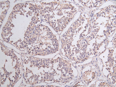 Immunofluorescence staining of Human testicular tissue with NSUN4 Antibody at 1:100, counter-stained with DAPI. The cells were fixed in 4% formaldehyde, permeabilized using 0.2% Triton X-100 and blocked in 10% normal Goat Serum. The cells were then incubated with the antibody overnight at 4°C. The secondary antibody was Alexa Fluor 488-congugated AffiniPure Goat Anti-Rabbit IgG(H+L).Rabbit anti-Human NSUN4 Polyclonal Antibody