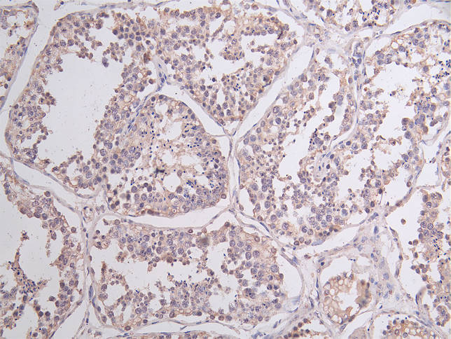 Immunofluorescence staining of Human testicular tissue with NSUN4 Antibody at 1:100, counter-stained with DAPI. The cells were fixed in 4% formaldehyde, permeabilized using 0.2% Triton X-100 and blocked in 10% normal Goat Serum. The cells were then incubated with the antibody overnight at 4°C. The secondary antibody was Alexa Fluor 488-congugated AffiniPure Goat Anti-Rabbit IgG(H+L).Rabbit anti-Human NSUN4 Polyclonal Antibody