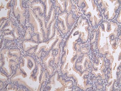 Immunofluorescence staining of human prostate tissue with NSUN4 Antibody at 1:100, counter-stained with DAPI. The cells were fixed in 4% formaldehyde, permeabilized using 0.2% Triton X-100 and blocked in 10% normal Goat Serum. The cells were then incubated with the antibody overnight at 4°C. The secondary antibody was Alexa Fluor 488-congugated AffiniPure Goat Anti-Rabbit IgG(H+L).Rabbit anti-Human NSUN4 Polyclonal Antibody