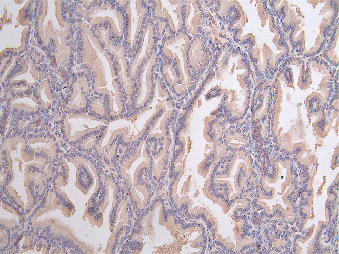 Immunofluorescence staining of human prostate tissue with NSUN4 Antibody at 1:100, counter-stained with DAPI. The cells were fixed in 4% formaldehyde, permeabilized using 0.2% Triton X-100 and blocked in 10% normal Goat Serum. The cells were then incubated with the antibody overnight at 4°C. The secondary antibody was Alexa Fluor 488-congugated AffiniPure Goat Anti-Rabbit IgG(H+L).Rabbit anti-Human NSUN4 Polyclonal Antibody