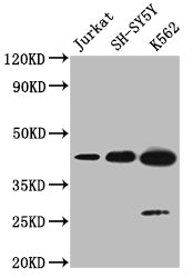 Western BlotPositive WB detected in: Jurkat whole cell lysate, SH-SY5Y whole cell lysate, K562 whole cell lysateAll lanes: NSUN4 antibody at 1:2000SecondaryGoat polyclonal to rabbit IgG at 1/50000 dilutionPredicted band size: 44, 17, 22, 38 kDaObserved band size: 44 kDaRabbit anti-Human NSUN4 Polyclonal Antibody