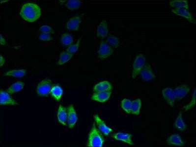 Immunofluorescent analysis of LO2 cells using GPR146 Antibody at dilution of 1:100 and Alexa Fluor 488-congugated AffiniPure Goat Anti-Rabbit IgG(H+L)Rabbit anti-Human GPR146 Polyclonal Antibody