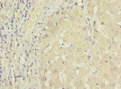 Immunohistochemistry of paraffin-embedded human liver tissue using the antibody at dilution of 1:100Rabbit anti-Human GPR146 Polyclonal Antibody