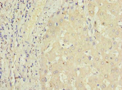 Immunohistochemistry of paraffin-embedded human liver tissue using the antibody at dilution of 1:100Rabbit anti-Human GPR146 Polyclonal Antibody