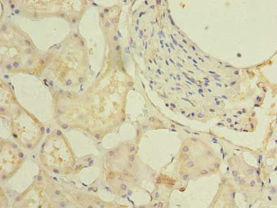 Immunohistochemistry of paraffin-embedded human kidney tissue using GPR146 Antibody at dilution of 1:100Rabbit anti-Human GPR146 Polyclonal Antibody