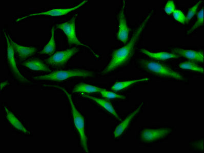 Immunofluorescence staining of Hela cells with LRRC45 Antibody at 1:133, counter-stained with DAPI. The cells were fixed in 4% formaldehyde, permeabilized using 0.2% Triton X-100 and blocked in 10% normal Goat Serum. The cells were then incubated with the antibody overnight at 4°C. The secondary antibody was Alexa Fluor 488-congugated AffiniPure Goat Anti-Rabbit IgG(H+L).