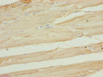 Immunohistochemistry of paraffin-embedded human skeletal muscle tissue using RMDN1 Antibody at dilution of 1:100Rabbit anti-Human RMDN1 Polyclonal Antibody
