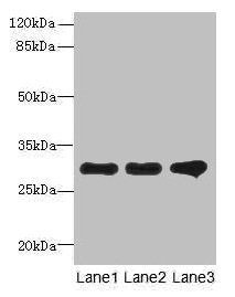 Western blot  | All lanes: RMDN1 antibody at 0.6µg/ml  | Lane 1: K562 whole cell lysate  | Lane 2: HepG2 whole cell lysate  | Lane 3: MCF-7 whole cell lysate  | Secondary  | Goat polyclonal to rabbit IgG at 1/10000 dilution  | Predicted band size: 36, 33, 31 kDa  | Observed band size: 31 kDaRabbit anti-Human RMDN1 Polyclonal Antibody