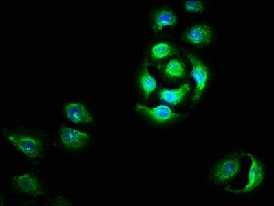 Immunofluorescence staining of A549 cells with OTUD5 Antibody at 1:100, counter-stained with DAPI. The cells were fixed in 4% formaldehyde, permeabilized using 0.2% Triton X-100 and blocked in 10% normal Goat Serum. The cells were then incubated with the antibody overnight at 4°C. The secondary antibody was Alexa Fluor 488-congugated AffiniPure Goat Anti-Rabbit IgG(H+L).Rabbit anti-Human OTUD5 Polyclonal Antibody