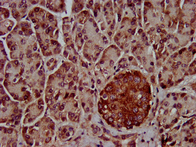 IHC image of CLPTM1L Antibody diluted at 1:800 and staining in paraffin-embedded human pancreatic tissue performed on a Leica BondTM system. After dewaxing and hydration, antigen retrieval was mediated by high pressure in a citrate buffer (pH 6.0). Section was blocked with 10% normal goat serum 30min at RT. Then primary antibody (1% BSA) was incubated at 4°C overnight. The primary is detected by a biotinylated secondary antibody and visualized using an HRP conjugated SP system.Rabbit anti-Human CLPTM1L Polyclonal Antibody