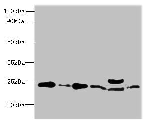 Western blot | All lanes: RPL10L antibody at 4μg/ml | Lane 1: Jurkat whole cell lysate | Lane 2: Hela whole cell lysate | Lane 3: HL60 whole cell lysate | Lane 4: K562 whole cell lysate | Lane 5: Mouse liver tissue | Lane 6: MCF-7 whole cell lysate | Secondary | Goat polyclonal to Rabbit IgG at 1/10000 dilution | Predicted band size: 25 kDa | Observed band size: 25 kDaRabbit anti-Human RPL10L Polyclonal Antibody