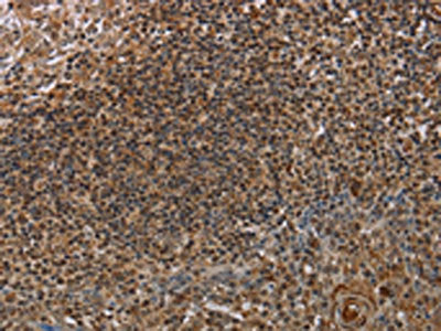 The image on the left is immunohistochemistry of paraffin-embedded Human tonsil tissue using MARK1 Antibody(MARK1 Antibody) at dilution 1/40, on the right is treated with synthetic peptide. (Original magnification: ×200)