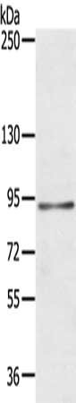 Gel: 6%SDS-PAGE, Lysate: 40 μg, Lane: K562 cells, Primary antibody: MARK1 Antibody(MARK1 Antibody) at dilution 1/200, Secondary antibody: Goat anti rabbit IgG at 1/8000 dilution, Exposure time: 3 minutes