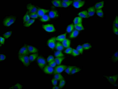 Immunofluorescence staining of Hela cells with GSDMA Antibody at 1:133, counter-stained with DAPI. The cells were fixed in 4% formaldehyde, permeabilized using 0.2% Triton X-100 and blocked in 10% normal Goat Serum. The cells were then incubated with the antibody overnight at 4°C. The secondary antibody was Alexa Fluor 488-congugated AffiniPure Goat Anti-Rabbit IgG(H+L).Rabbit anti-Human GSDMA Polyclonal Antibody