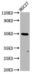 Western Blot  | Positive WB detected in: HGC27 whole cell lysate  | All lanes: GSDMA antibody at 3.85µg/ml  | Secondary  | Goat polyclonal to rabbit IgG at 1/50000 dilution  | Predicted band size: 50 kDa  | Observed band size: 50 kDaRabbit anti-Human GSDMA Polyclonal Antibody