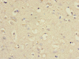 Immunohistochemistry of paraffin-embedded human brain tissue using SLC2A13 Antibody at dilution of 1:100Rabbit anti-Human SLC2A13 Polyclonal Antibody