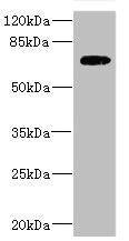 Western blot | All lanes: SLC2A13 antibody IgG at 2.88μg/ml + HepG2 whole cell lysate | Secondary | Goat polyclonal to rabbit IgG at 1/10000 dilution | Predicted band size: 70 kDa | Observed band size: 70 kDaRabbit anti-Human SLC2A13 Polyclonal Antibody