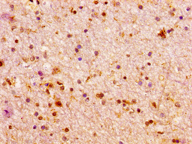IHC image of ARX Antibody diluted at 1:100 and staining in paraffin-embedded human brain tissue performed on a Leica BondTM system. After dewaxing and hydration, antigen retrieval was mediated by high pressure in a citrate buffer (pH 6.0). Section was blocked with 10% normal goat serum 30min at RT. Then primary antibody (1% BSA) was incubated at 4°C overnight. The primary is detected by a biotinylated secondary antibody and visualized using an HRP conjugated SP system.Rabbit anti-Human ARX Polyclonal Antibody