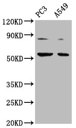Western Blot | Positive WB detected in: PC-3 whole cell lysate, A549 whole cell lysate | All lanes: ARX antibody at 1:2000 | Secondary | Goat polyclonal to rabbit IgG at 1/50000 dilution | Predicted band size: 59 kDa | Observed band size: 59 kDaRabbit anti-Human ARX Polyclonal Antibody