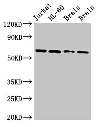 Western Blot | Positive WB detected in: Jurkat whole cell lysate, HL60 whole cell lysate, Rat brain tissue, Mouse brain tissue | All lanes: ARX antibody at 2.7μg/ml | Secondary | Goat polyclonal to rabbit IgG at 1/50000 dilution | Predicted band size: 59 kDa | Observed band size: 59 kDa