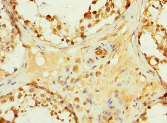 Immunohistochemistry of paraffin-embedded human testis tissue using HHIP Antibody at dilution of 1:100Rabbit anti-Human HHIP Polyclonal Antibody