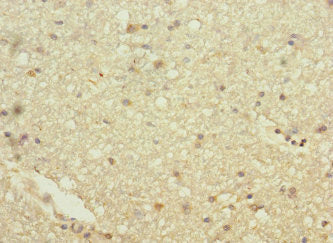 Immunohistochemistry of paraffin-embedded human brain tissue using HHIP Antibody at dilution of 1:100Rabbit anti-Human HHIP Polyclonal Antibody