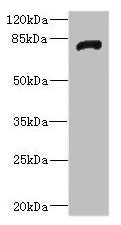 Western blot | All lanes: HHIPantibody IgG at 1.92μg/ml + Rat heart tissue | Secondary | Goat polyclonal to rabbit IgG at 1/10000 dilution | Predicted band size: 79, 37 kDa | Observed band size: 79 kDaRabbit anti-Human HHIP Polyclonal Antibody