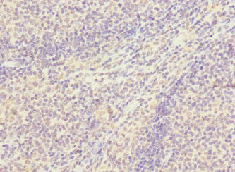 Immunohistochemistry of paraffin-embedded human tonsil tissue using SNX18 Antibody at dilution of 1:100Rabbit anti-Human SNX18 Polyclonal Antibody