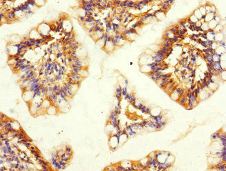 Immunohistochemistry of paraffin-embedded human small intestine tissue using SNX18 Antibody at dilution of 1:100Rabbit anti-Human SNX18 Polyclonal Antibody