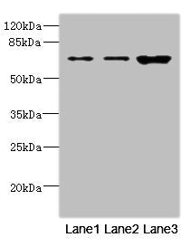 Western blot  | All lanes: SNX18 antibody at 1.6µg/ml  | Lane 1: A549 whole cell lysate  | Lane 2: Hela whole cell lysate  | Lane 3: Mouse kidney tissue  | Secondary  | Goat polyclonal to rabbit IgG at 1/10000 dilution  | Predicted band size: 69, 70, 65 kDa  | Observed band size: 69 kDaRabbit anti-Human SNX18 Polyclonal Antibody